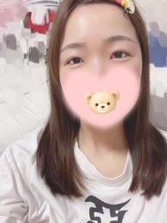 노출